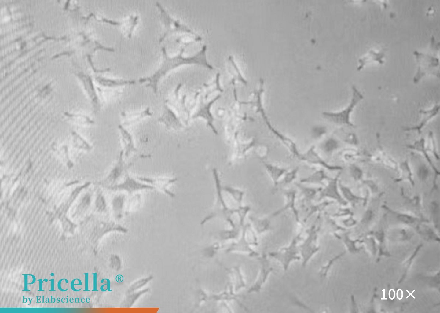 image of B16-F10 cells Figure 1