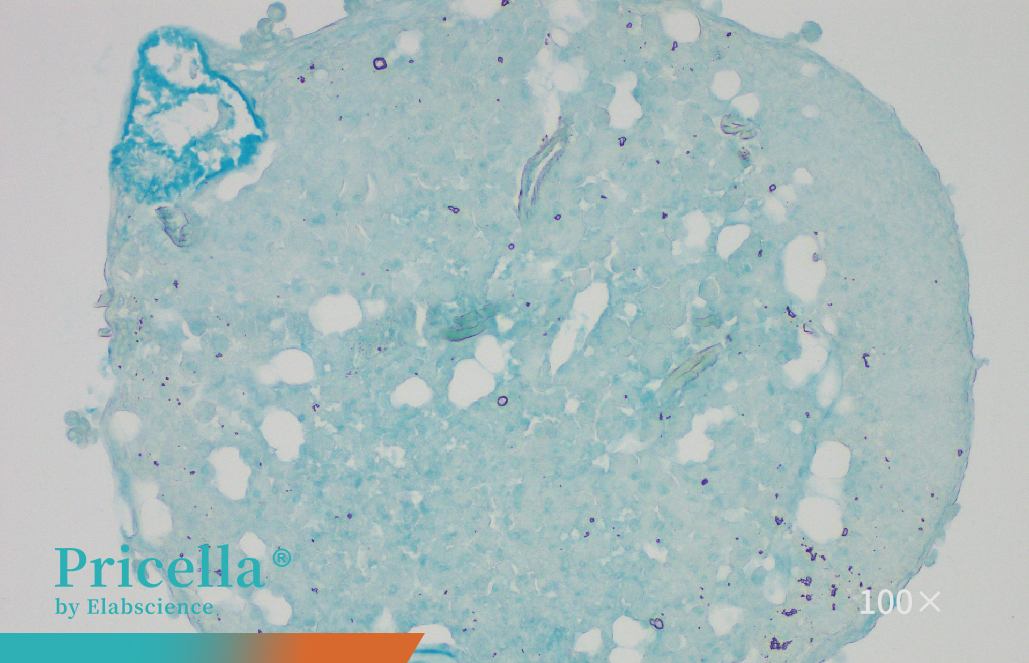 Chondrogenic Differentiation100x
