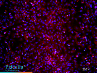 Mouse articular chondrocytes – Collagen II immunofluorescence image, 200x