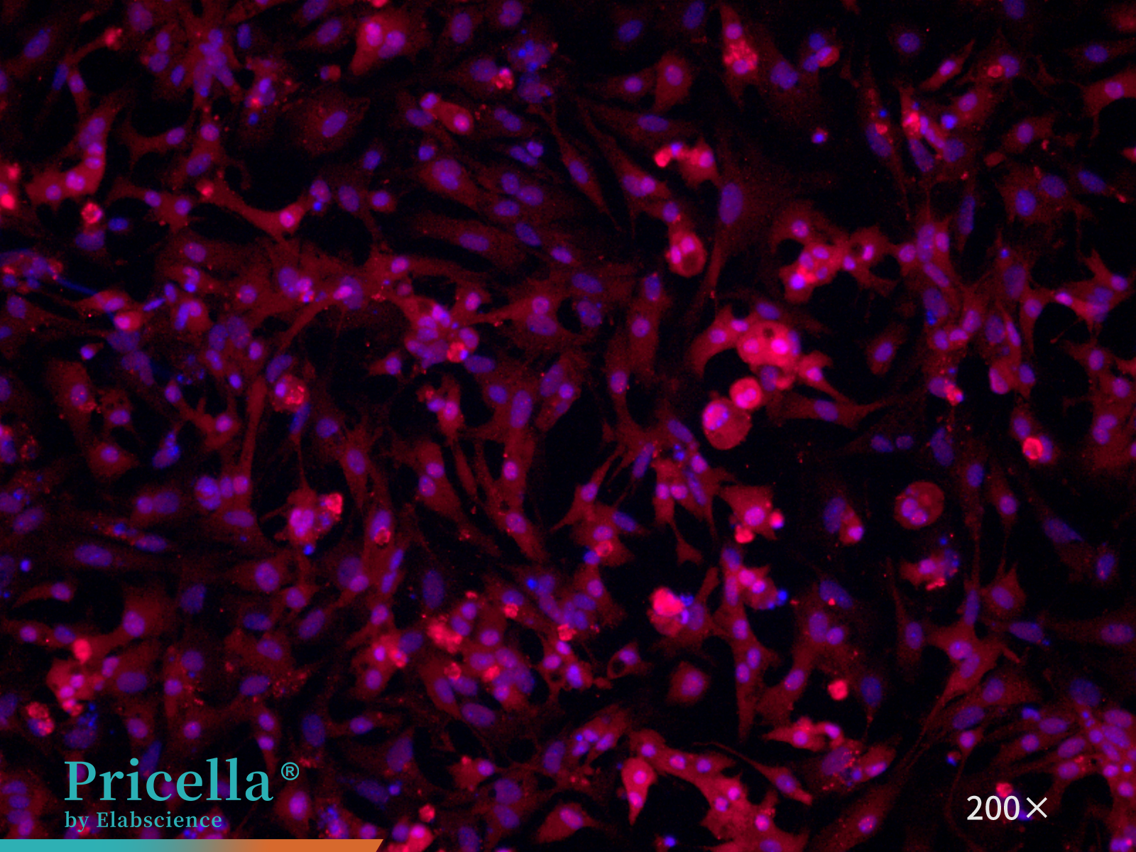 Mouse cardiomyocytes