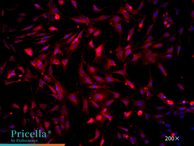 Rat hepatic sinusoidal endothelial cells CD31