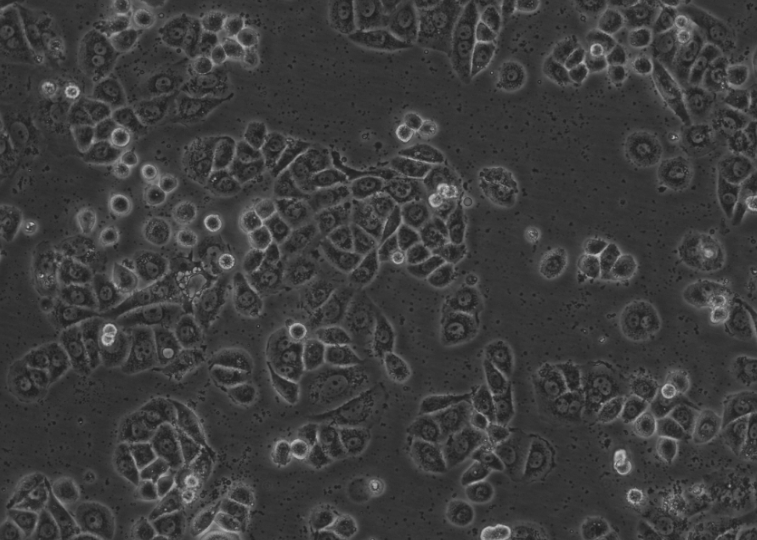 Representative morphology of cellular mycoplasma contamination