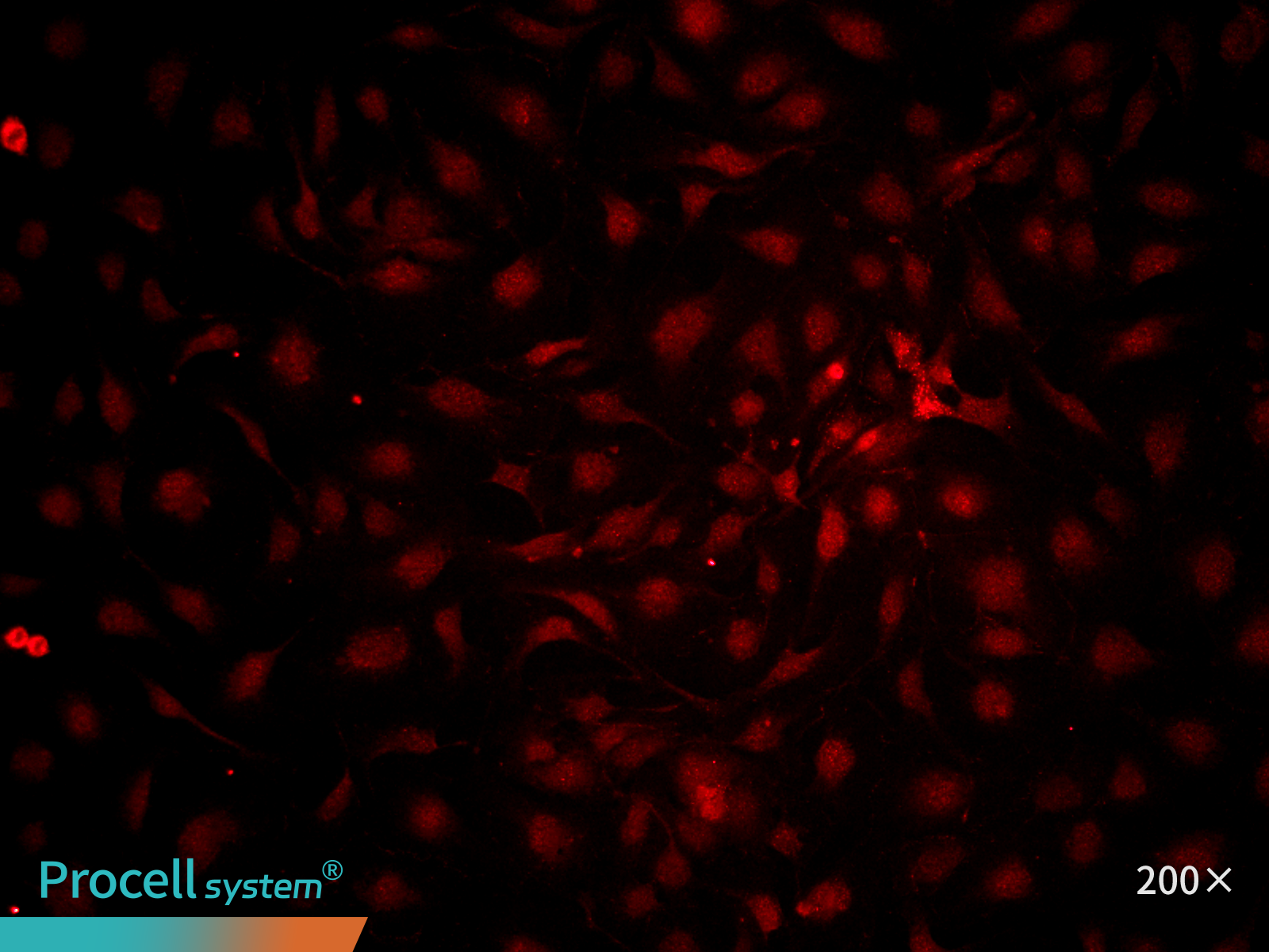 Immunofluorescence analysis of immortalized HUVECs (P25), CD31