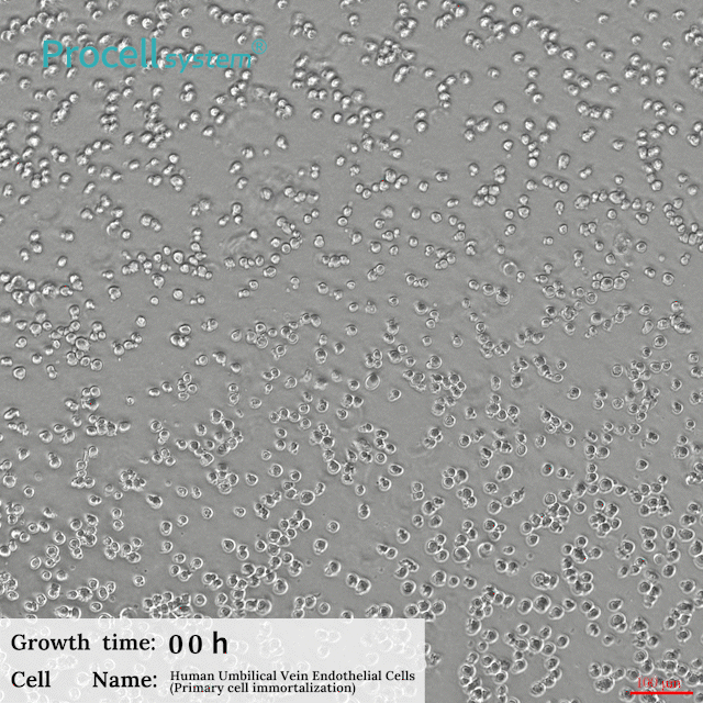 Human Umbilical Vein Endothelial (Primary cell immortalization) Cell Complete Medium
