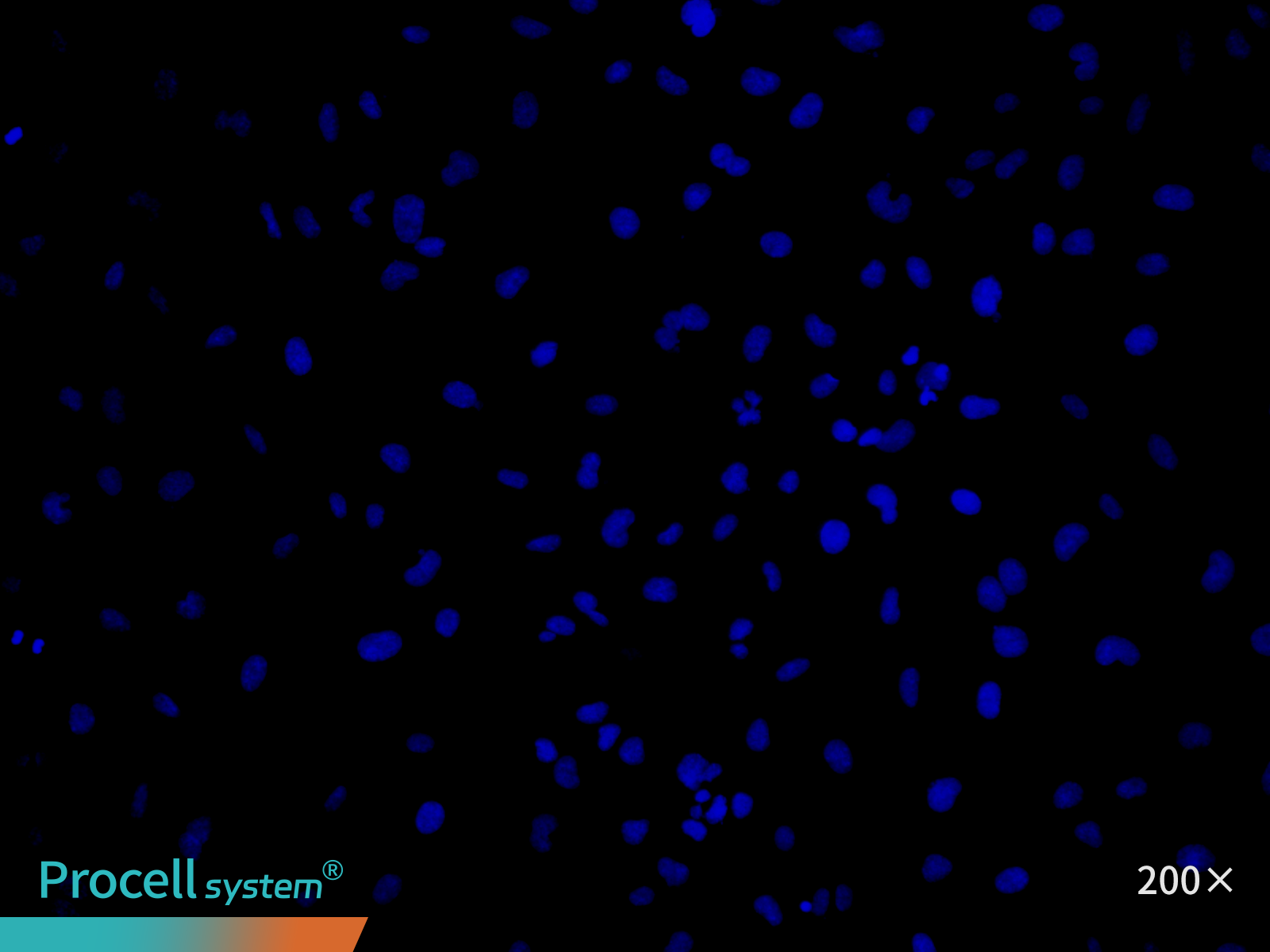Immunofluorescence analysis of immortalized HUVECs (P25), Hoechst