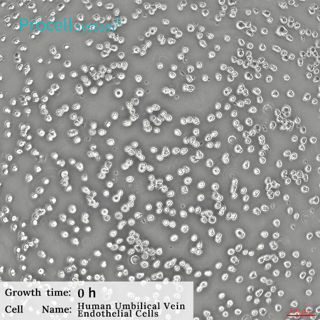 Human Umbilical Vein Endothelial Cell Complete Medium