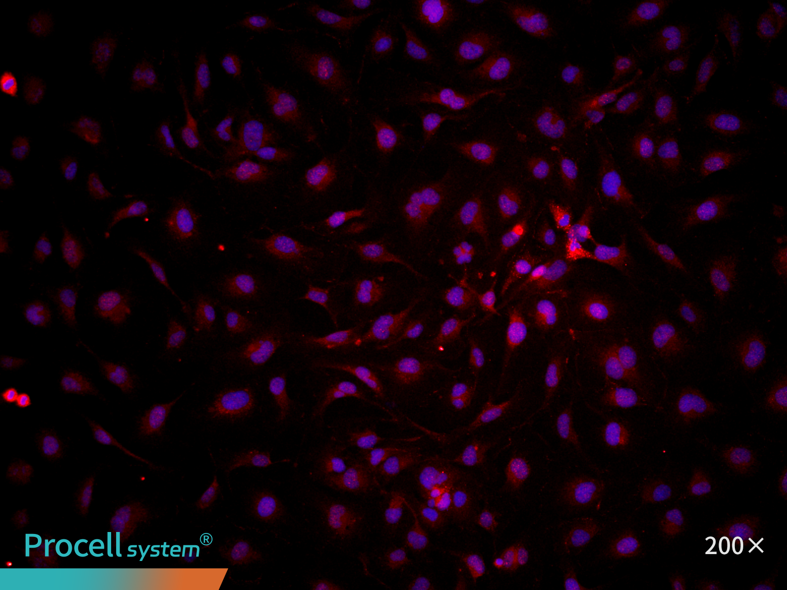 Immunofluorescence analysis of immortalized HUVECs (P25), Merge