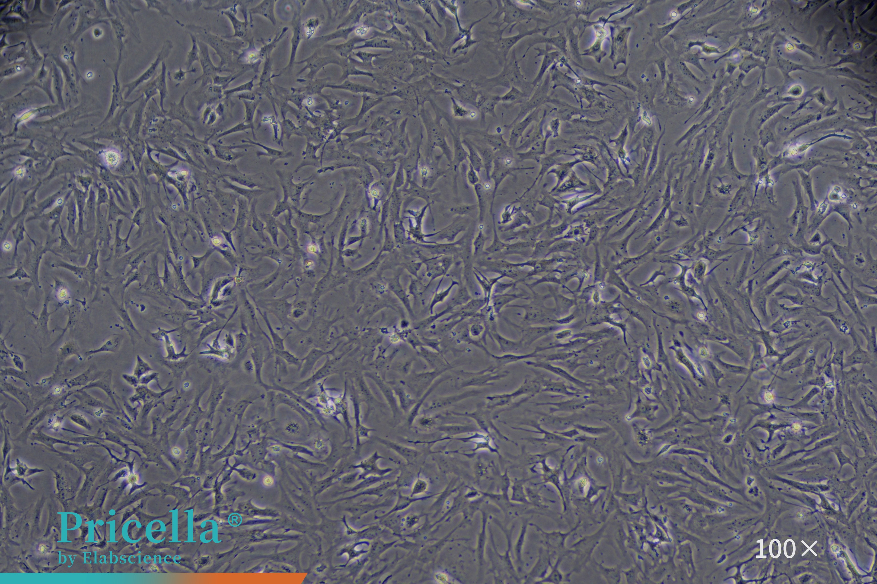 Mouse cardiac fibroblasts