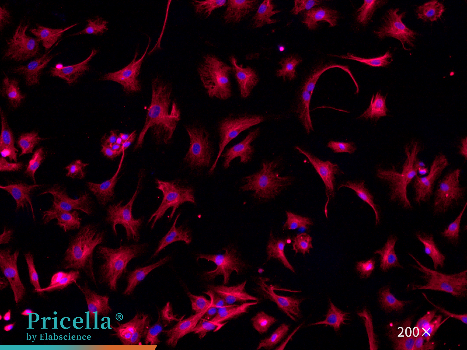 Mouse cardiac fibroblasts