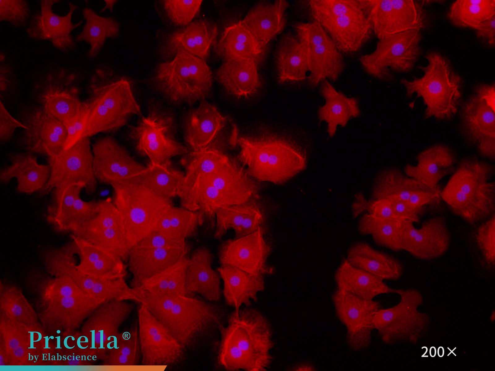 Mouse hepatic parenchymal cells CK-18