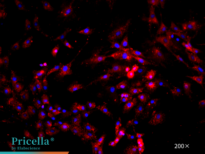 Mouse intervertebral disc annulus fibrosus cells – Collagen I immunofluorescence image,200x