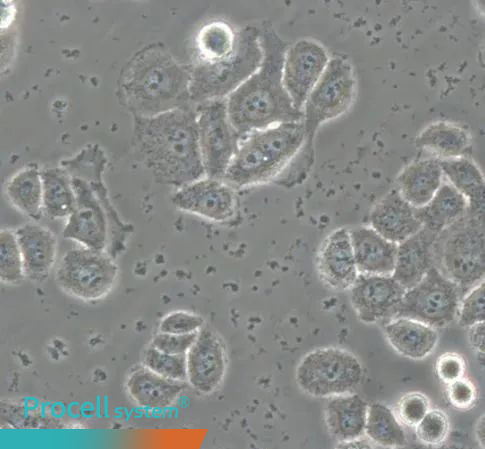 Representative morphology of cellular nanobacteria contamination