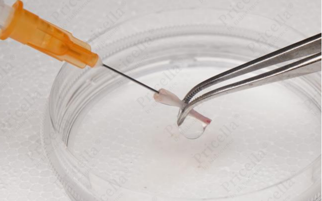 Stir the bone marrow with the needle andflushit