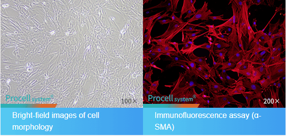Fig. 1 Morphological and Immunofluorescence Identification of Mouse Brain Microvascular Pericytes.
