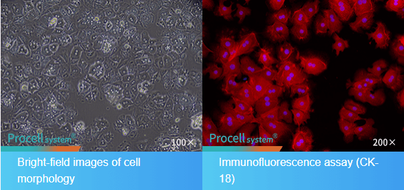 Fig. 2 Morphological and CK-18 Immunofluorescence Identification of Mouse Hepatic Parenchymal Cells.