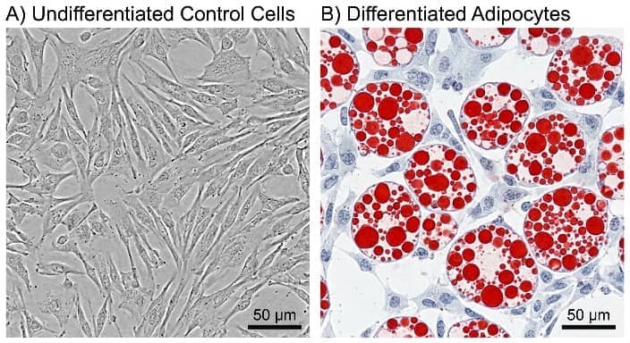 Oil Red O staining showing lipid accumulation in adipocytes.