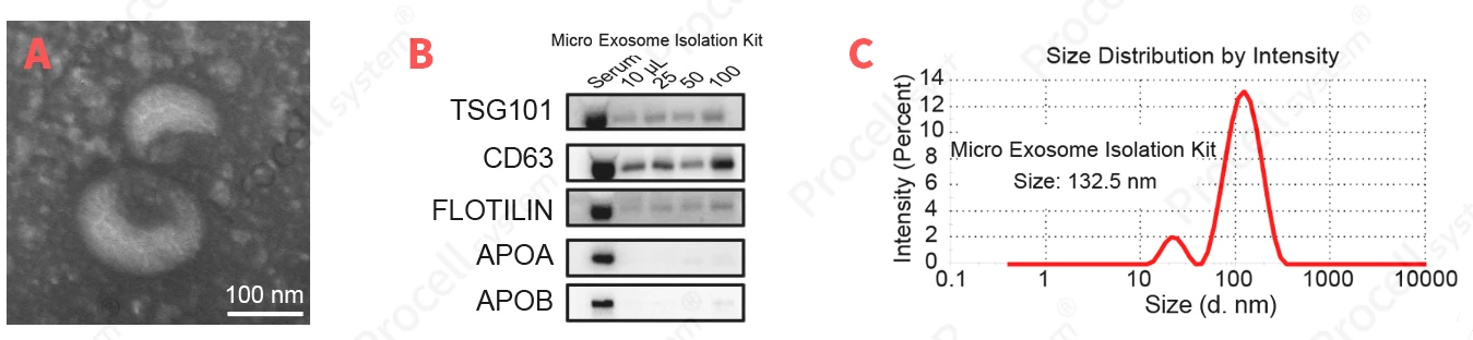 Exosome Purification and Characterization: Key Considerations for High-Quality Samples-1