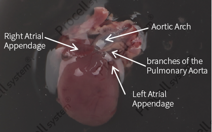 Cut off a mass of tissue containingthe pulmonary artery