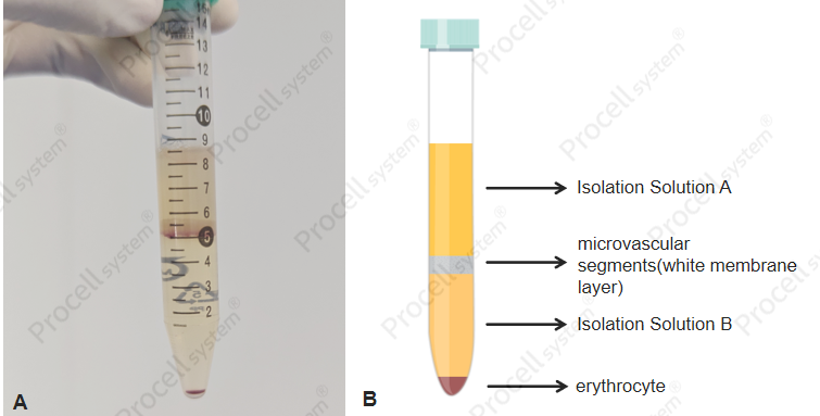 Cardiac Endothelial Cell Isolation Keeps Failing? Copy This High-purity ...