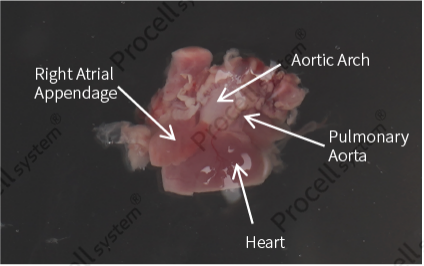 The blood clot-cleared tissue mass