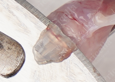 Using scalpel to excise the articular cartilage tissue