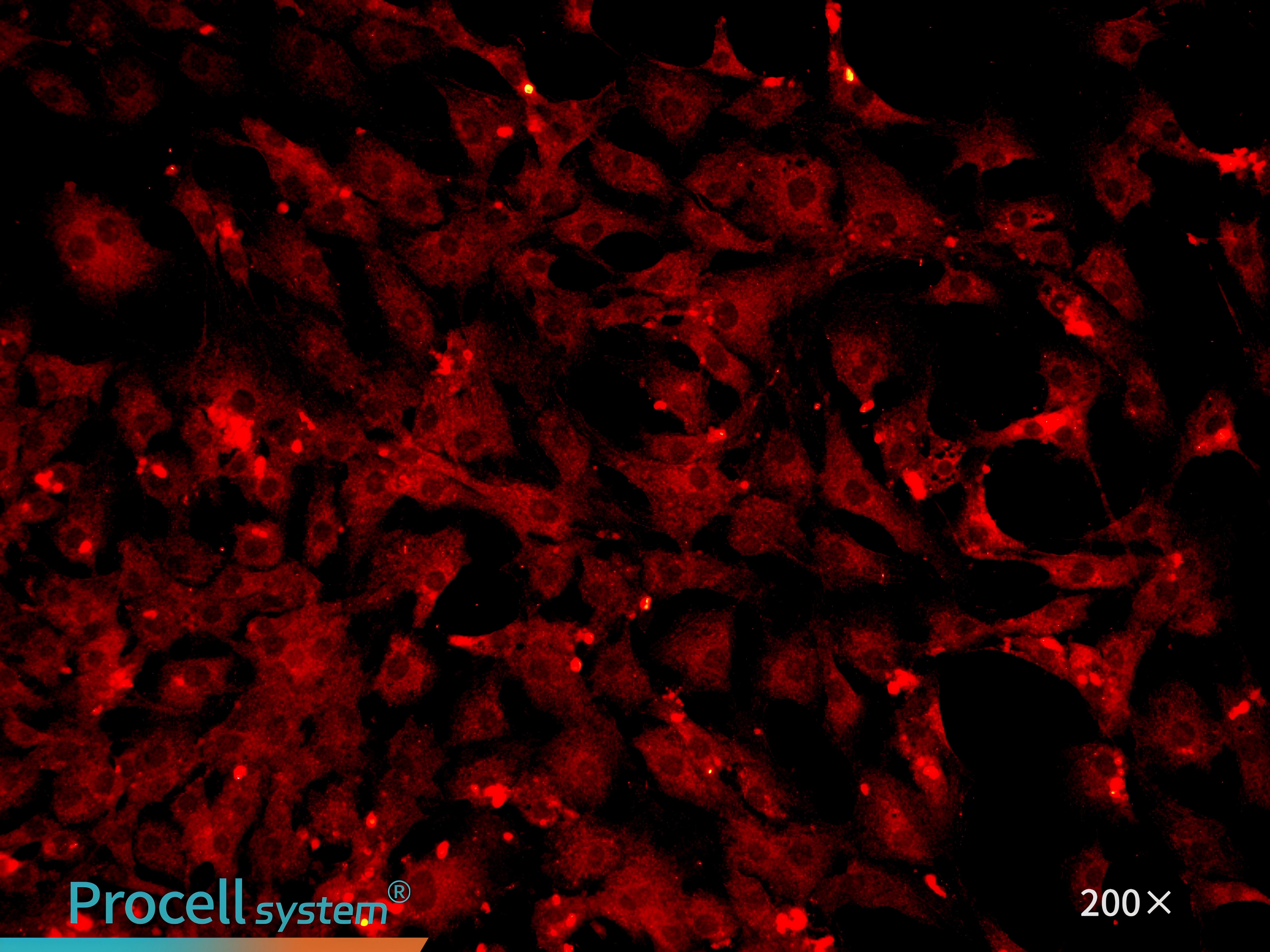 Immunofluorescence staining for the endothelial celll-specific marker CD31 confirms cell purity, CD31