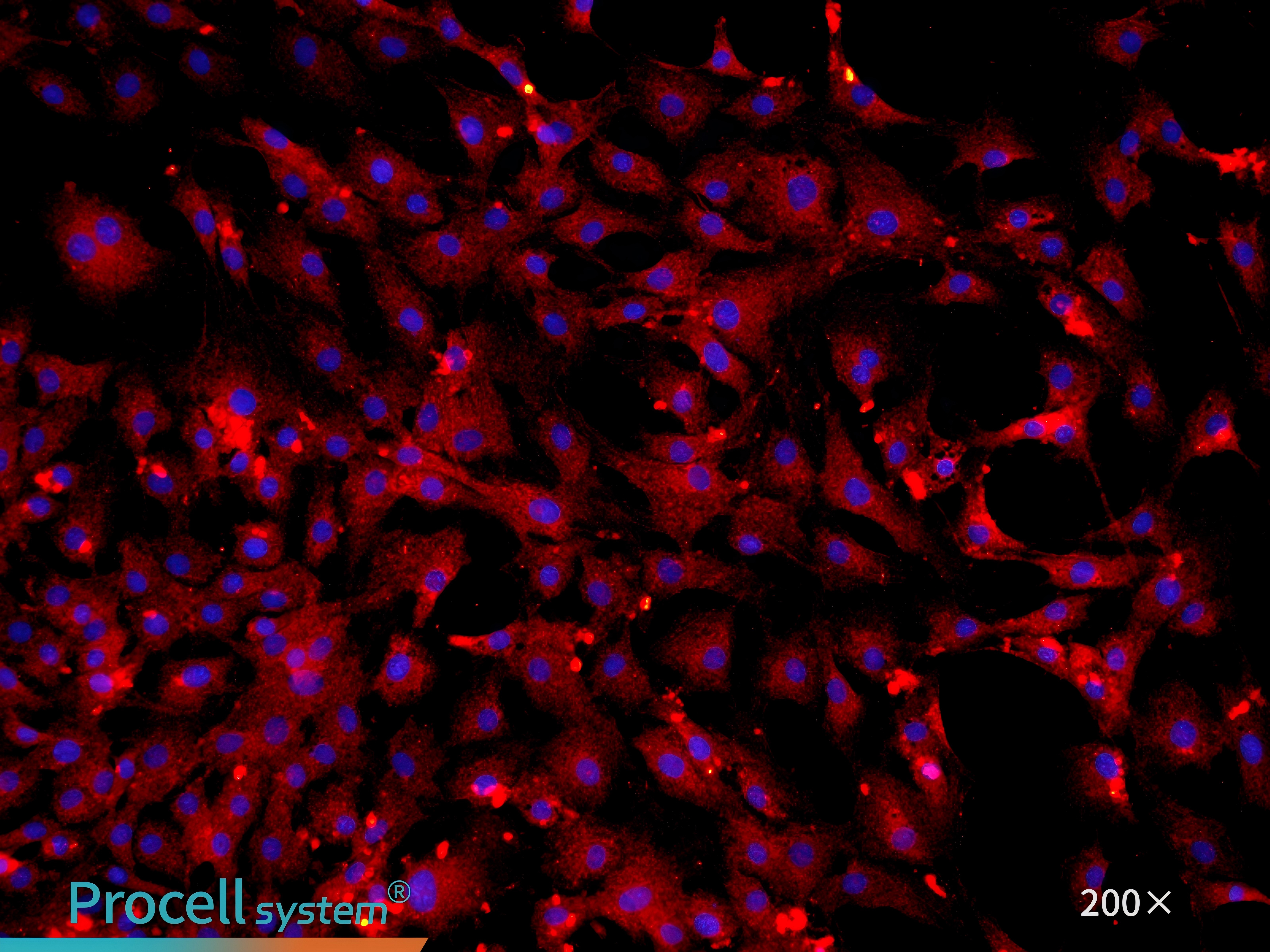 Immunofluorescence staining for the endothelial celll-specific marker CD31 confirms cell purity, Merge