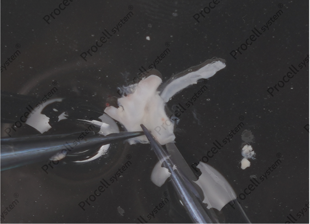 Cut open two blood vessels