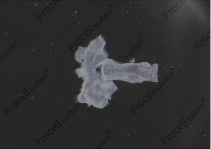 Cut the pulmonary artery tissuelongitudinally