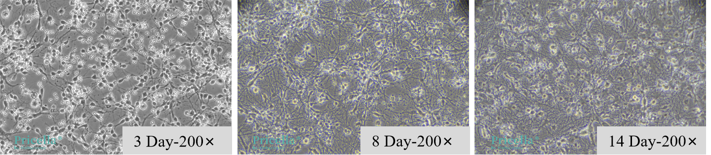 From Challenges to Breakthroughs in Culturing Neurons-3