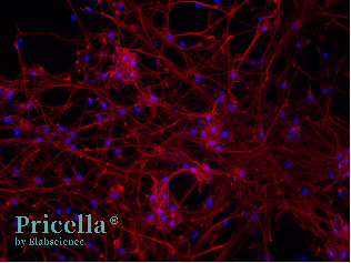 Simplify Primary Cell Isolation with Pricella® Kits-6