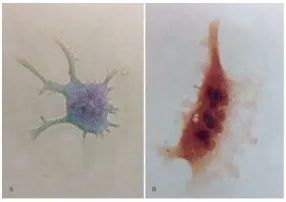 How to get osteoclasts by different induction methods?-1