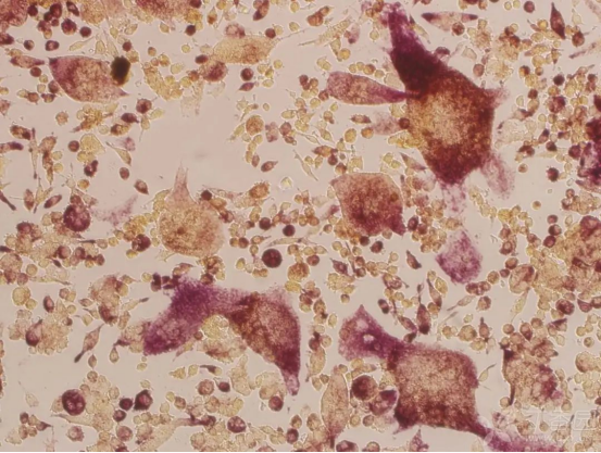 How to get osteoclasts by different induction methods?-3