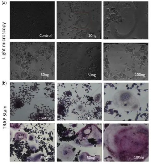 How to get osteoclasts by different induction methods?-2