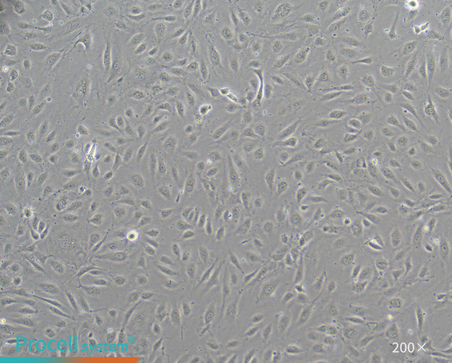 Morphology of immortalized HUVECs at P25