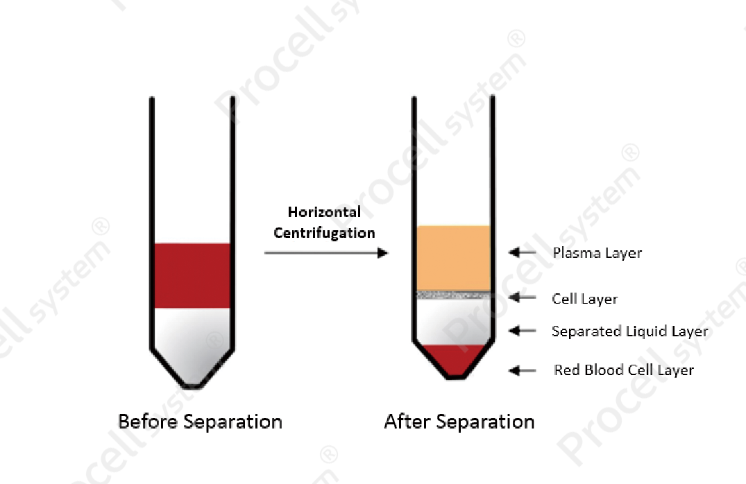 PBMC separation by Ficoll-Paque density gradient centrifugation.