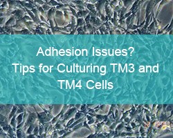 Adhesion Issues? Tips for Culturing TM3 and TM4 Cells - cover