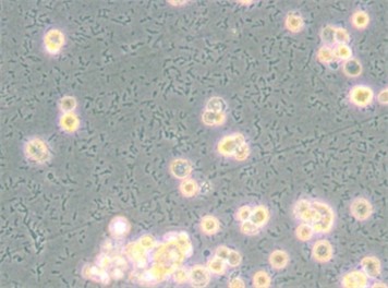 Common Types of Cell Culture Contamination-2