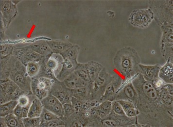 Common Types of Cell Culture Contamination-4