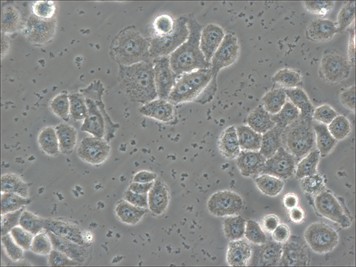Common Types of Cell Culture Contamination-5