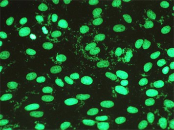 Common Types of Cell Culture Contamination-6