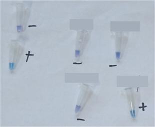 Common Types of Cell Culture Contamination-8