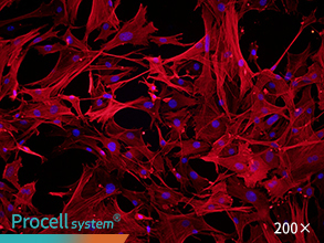 Immunofluorescence assay (α-SMA)