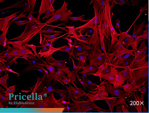 Immunofluorescence assay (α-SMA)