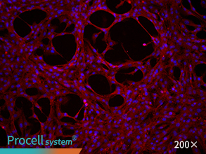 Immunofluorescence assay (CD31)