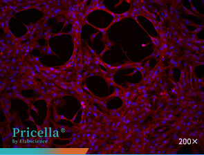 Immunofluorescence assay (CD31)