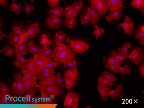 Immunofluorescence assay (CK-18)