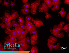 Immunofluorescence assay (CK-18)