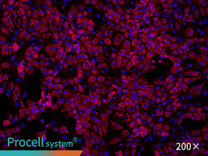 Immunofluorescence assay (Collagen I)