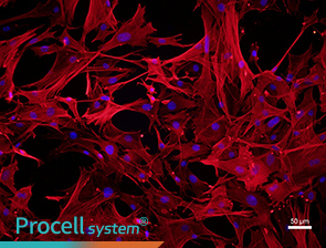Immunofluorescence assay (α-SMA)
